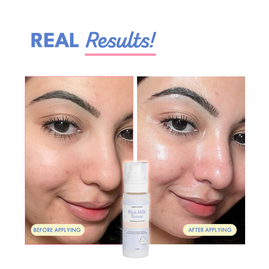 Rice Milk Toner: Brightening formula