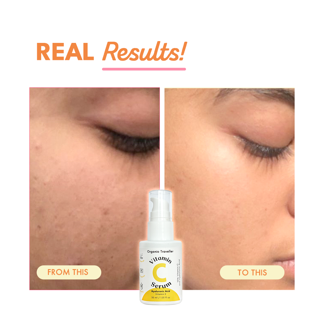 Super C: Vitamin C serum