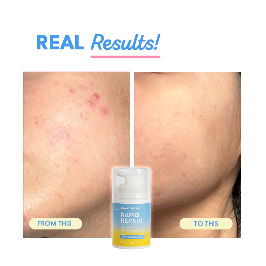 Rapid Repair: Barrier Repairing Moisturiser