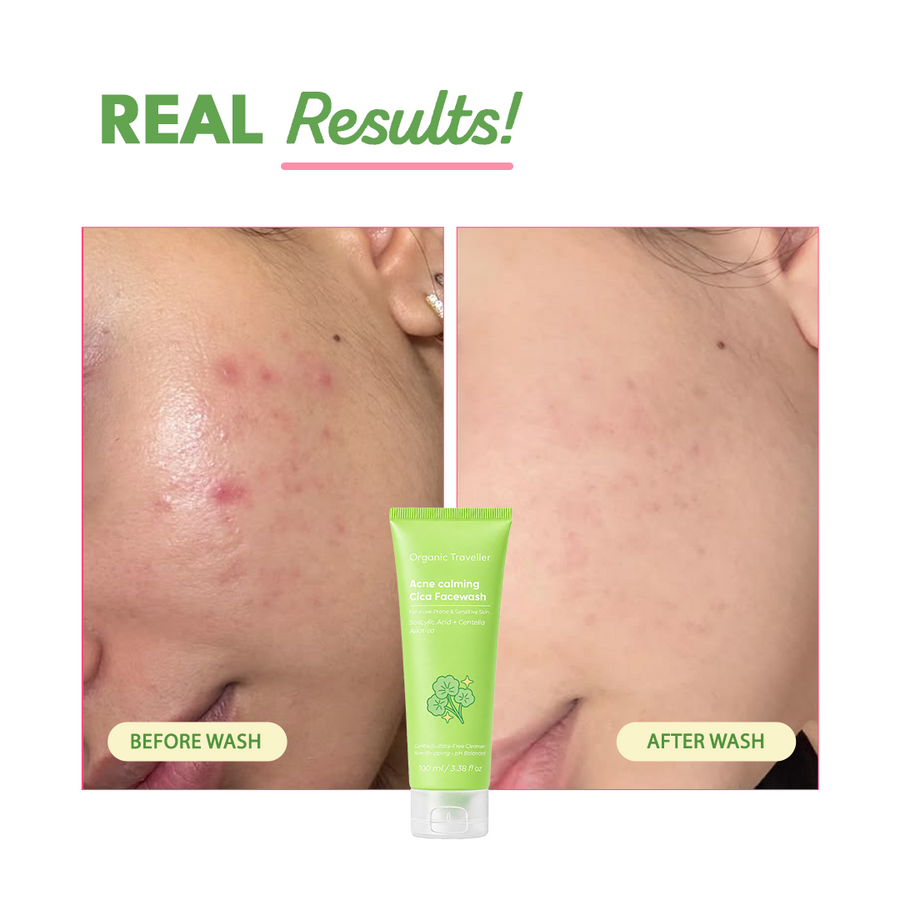 Acne Calming Cica Facewash