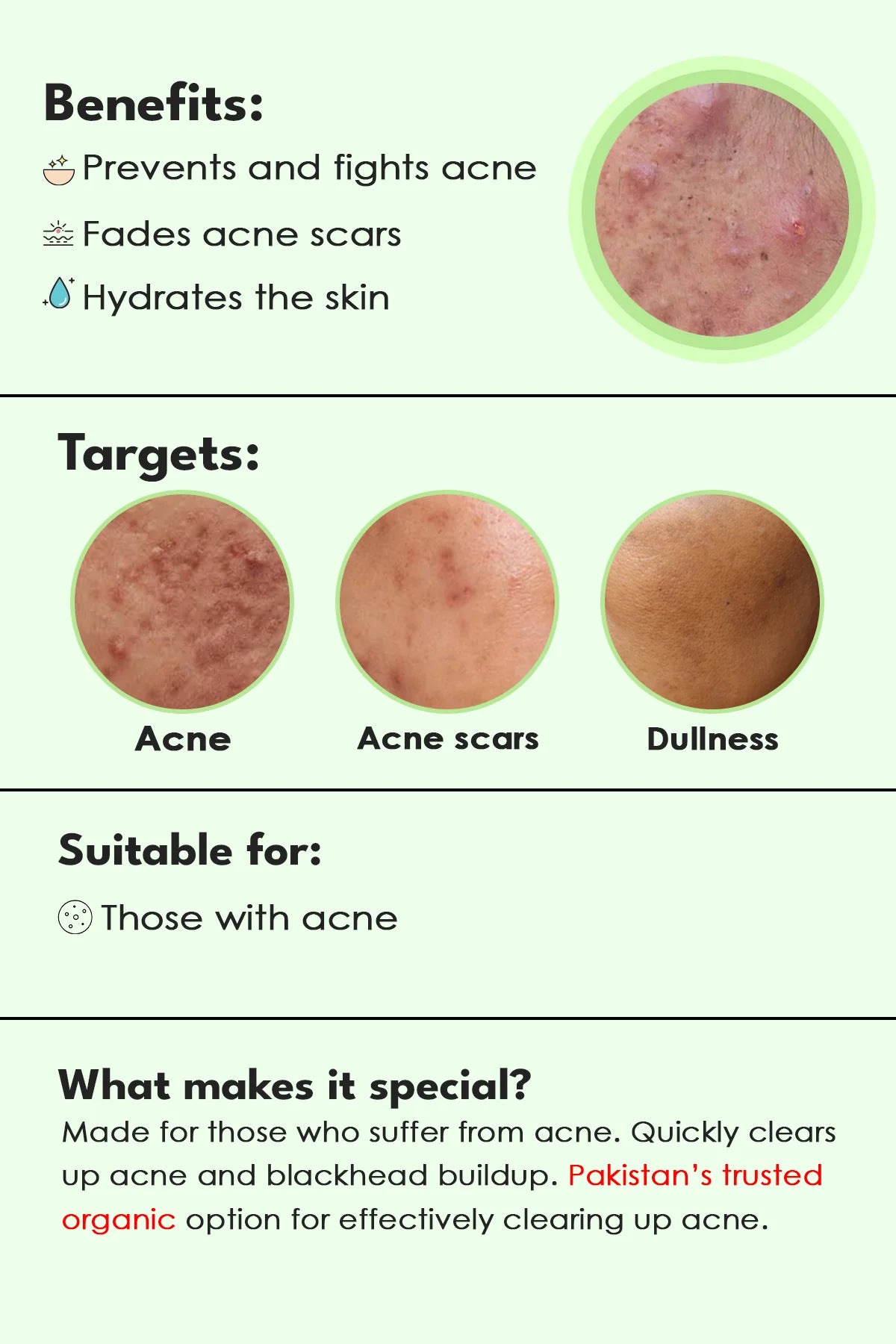 Clear: Acne clearing serum