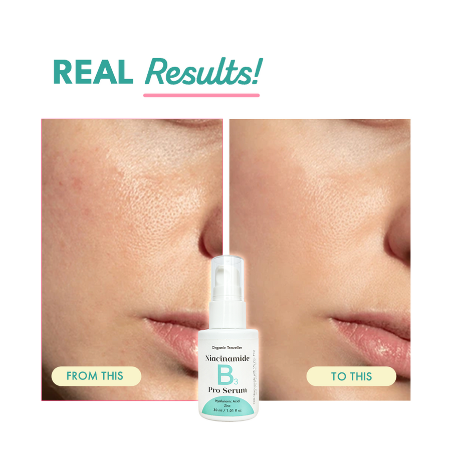 B3 PRO: Pore erasing serum