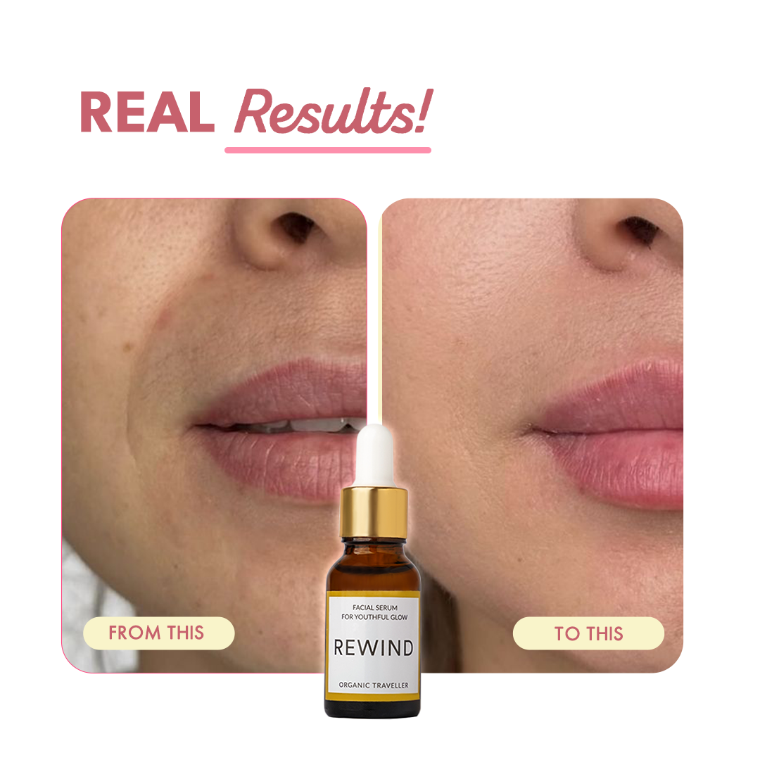 Rewind: Age Defying Serum