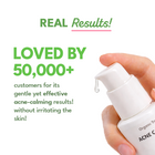 Acne Calming Serum