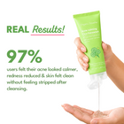 Acne Calming Cica Facewash