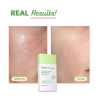 Cica Calming Sunscreen