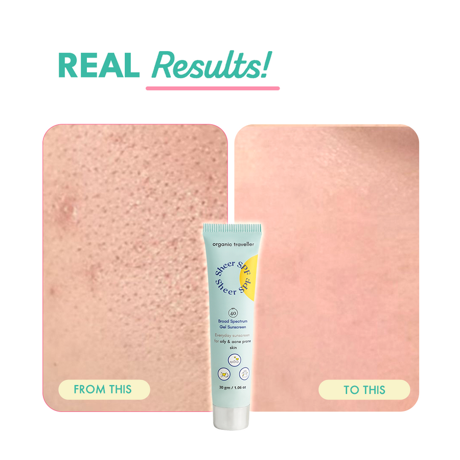 Sheer SPF: Oily/Acne Prone Skin Sunscreen (30 ML)