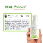 Acne Calming Serum