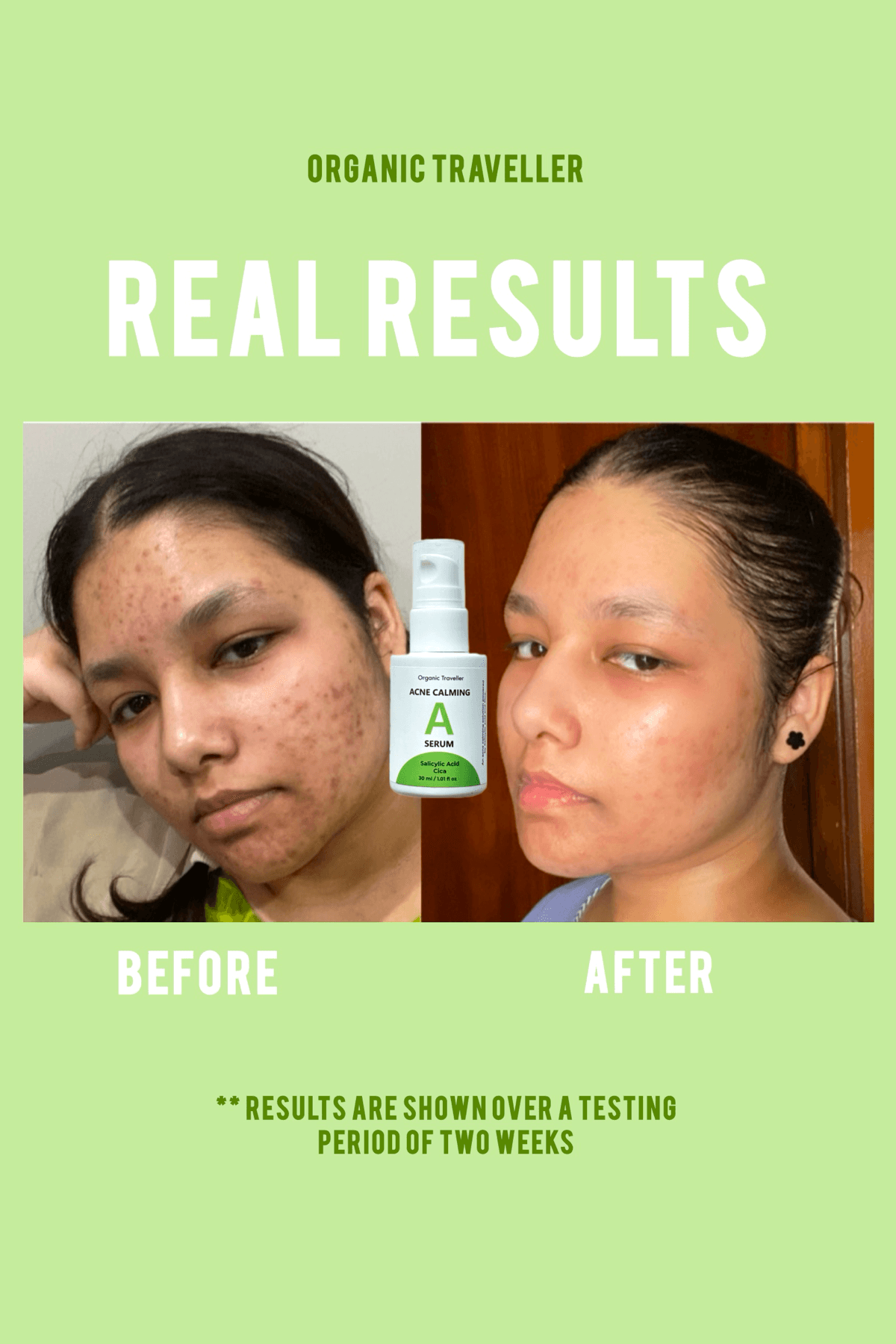 Acne Calming Serum - Organic Traveller Skincare 